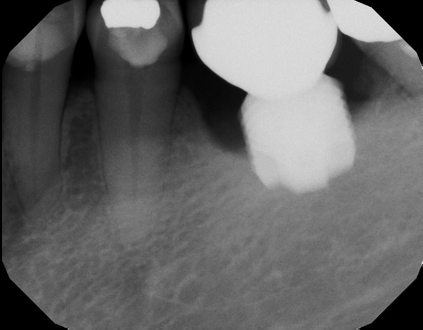 Before treatment