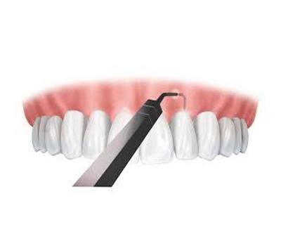 The pinhole surgical technique is a recent development in dentistry.