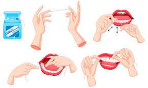 Dental flossing