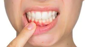 Long Island gum disease treatment by periodontists with the latest m