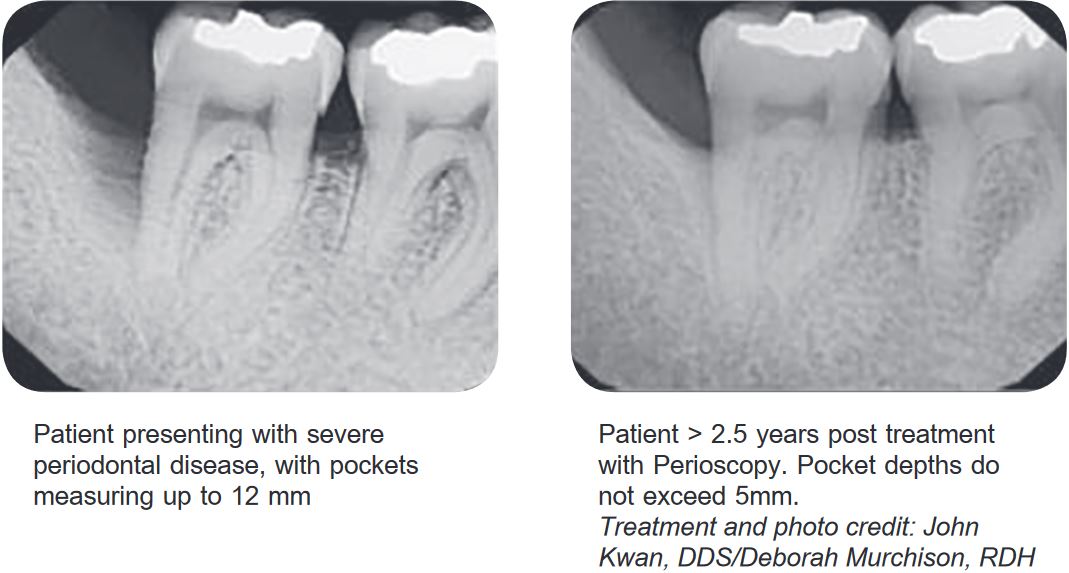 Long Island holistic dentist Farber Center provides advanced periodontal surgery.