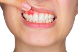 periodontal health long island ny