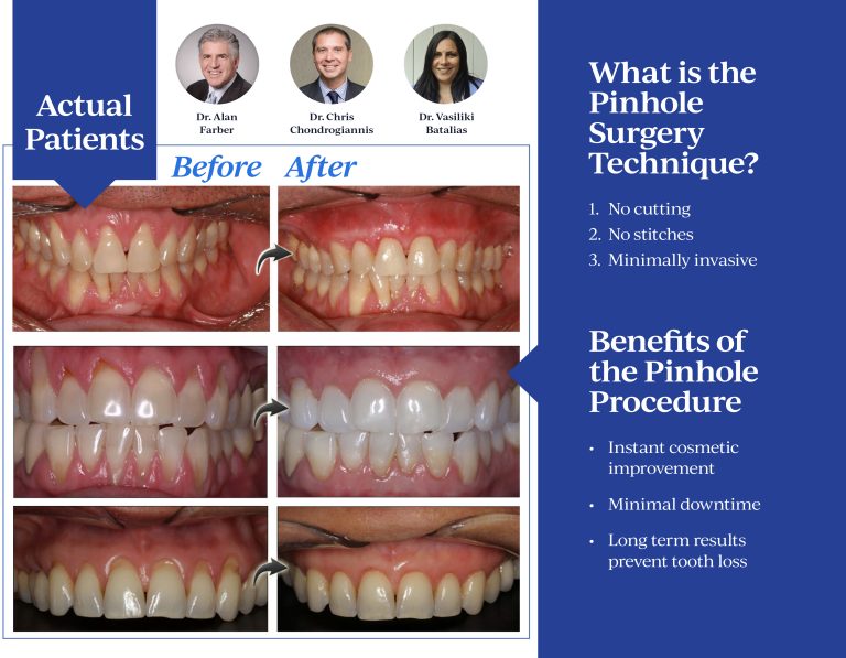 Pinhole® Surgical Technique Brochure – page 1